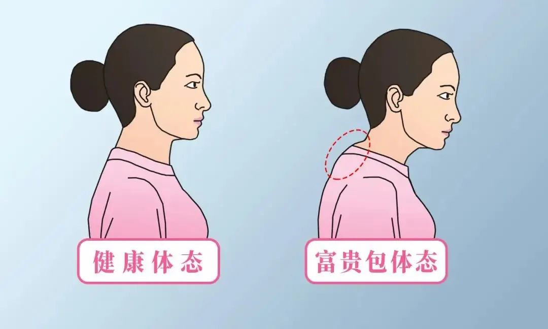 富贵包图.jpg