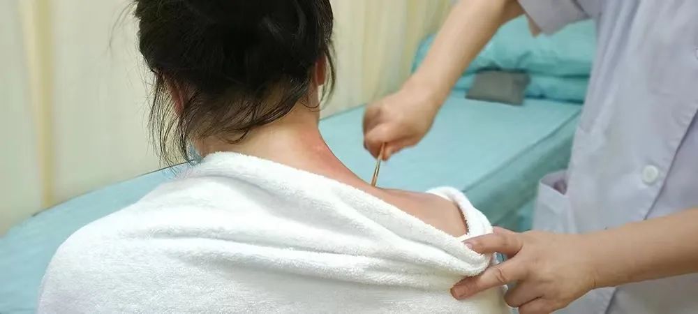 刮痧4.jpg