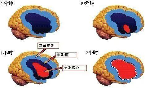 栓1.jpg
