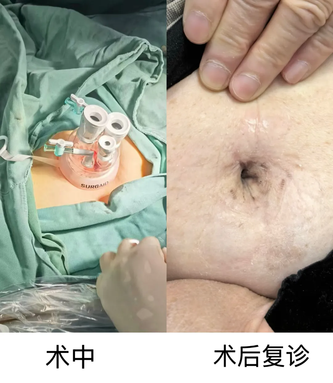 640.webp (1).png