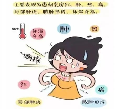 乳腺炎.jpg