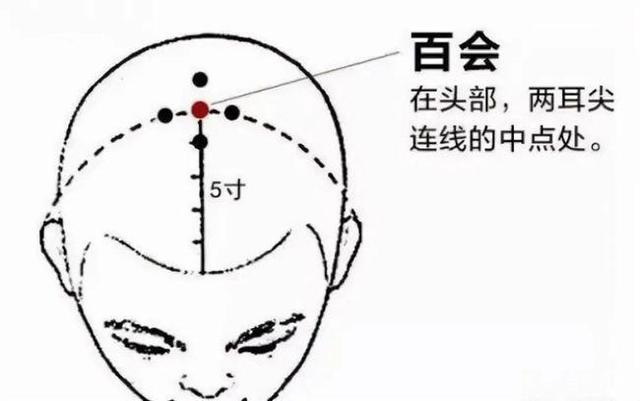 百会穴.png