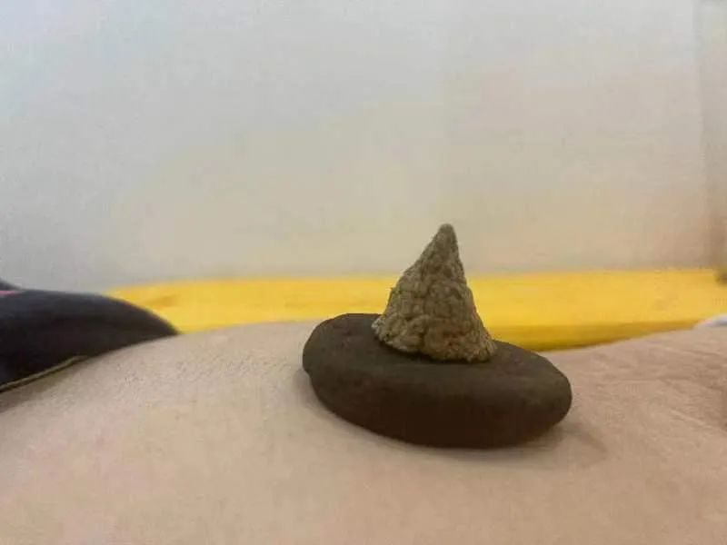 饼灸.jpg